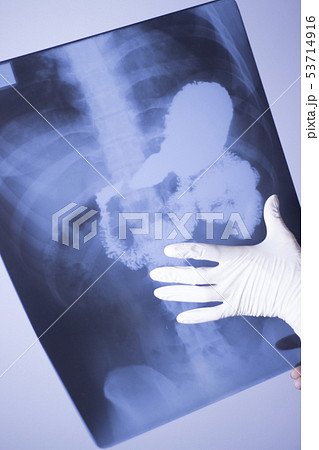 Medical xray spine hip scan 53714916