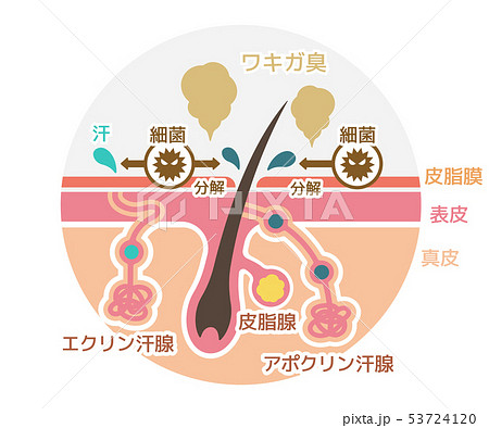 ワキガ臭発生の原因イラスト (腋臭・わきが) ワキガ臭発生の原因イラスト (腋臭・わきが) 53724120