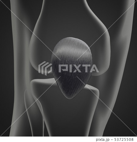 3d rendering of patella 3d rendering of patella 53725508