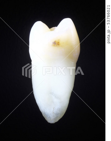歯（日本人/アジア） 53766021