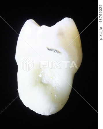 歯（日本人/アジア） 53766026