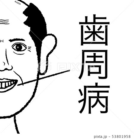 歯周病 53801958