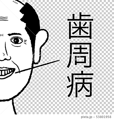歯周病 53801958
