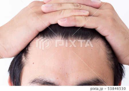 頭髪 頭髪 53846530