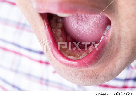 匂い 53847855