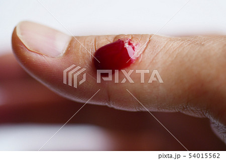 ケガ 出血 血 怪我 血液 指 白バック ボディパーツ 男性 日本人 切る 切り傷 傷の写真素材