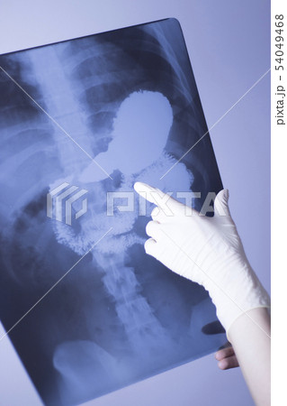 Medical xray spine hip scan Medical xray spine hip scan 54049468