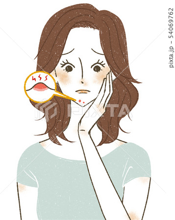 あごのニキビに悩む女性 あごのニキビに悩む女性 54069762