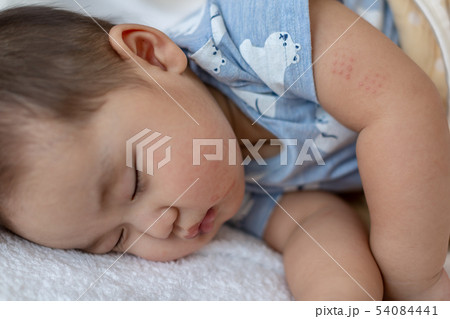 赤ちゃんの寝顔 gの痕の写真素材