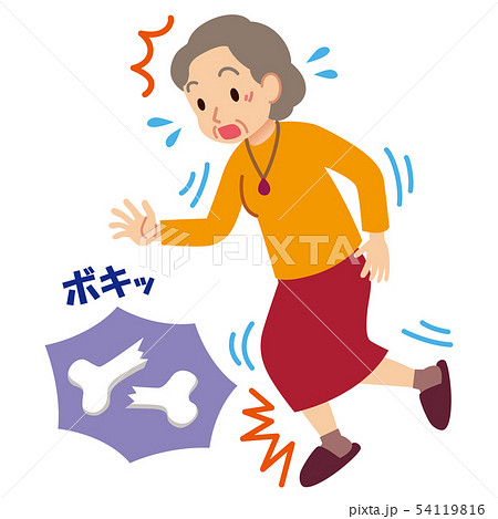 高齢者の骨折　骨粗鬆症 54119816