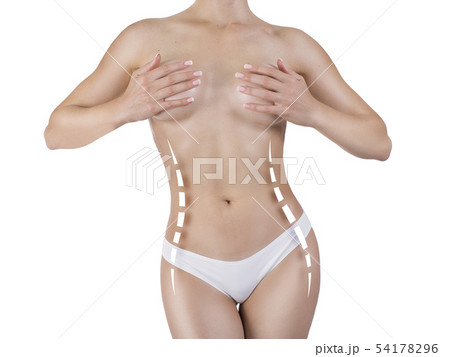 woman body with marks on waist. Slimming plastic surgery and dieting concept. woman body with marks on waist. Slimming plastic surgery and dieting concept. 54178296