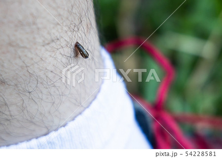Leech biting leg of person during hiking in Leech biting leg of person during hiking in 54228581