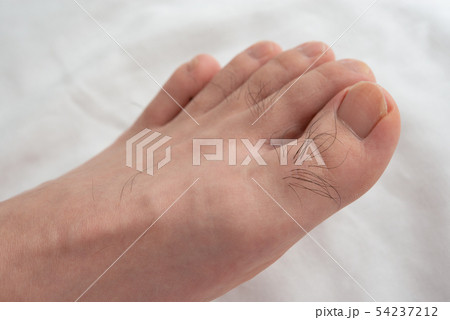 メンズ　足指脱毛　beforeイメージ 54237212