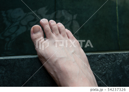 メンズ　足指脱毛　beforeイメージ 54237326