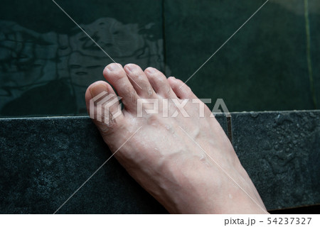 メンズ 足指脱毛 beforeイメージ メンズ 足指脱毛 beforeイメージ 54237327