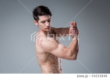 Studio portrait young Caucasian man on gray background posing. theme of puberty, problem skin, teen 54253646