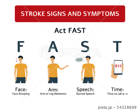 Stroke signs - symptoms of brain and heart health problem. 54328699