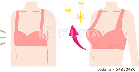 バストアップ　ビフォアアフター　女性の体 54350430