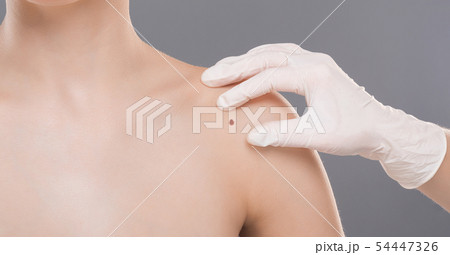 Dermatologist examining birthmark on woman shoulder, panorama 54447326