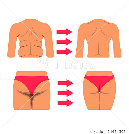 Set of White Woman Body Part. Fat and Sporty Body 54474505