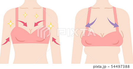 バストアップ　離れ乳　ビフォアアフター 54497388