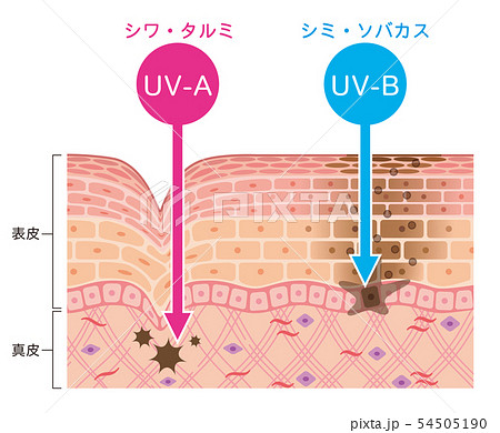 肌図 紫外線ダメージのイラスト素材