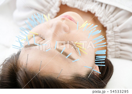 鍼灸院で顔に鍼を打たれる女性のアップ 54533295