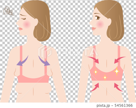背中　わき肉　ビフォアアフター　女性 54561366