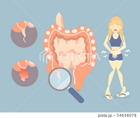 Woman Having Stomachache Appendictisのイラスト素材