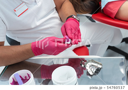 the dentist prepares material for the cast 54760537