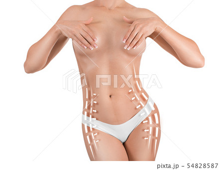 Woman marked out for cosmetic surgery. Liposuction concept, isolated on white background Woman marked out for cosmetic surgery. Liposuction concept, isolated on white background 54828587