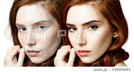 Young woman before and after skin treatment and makeup. Young woman before and after skin treatment and makeup. 54889893