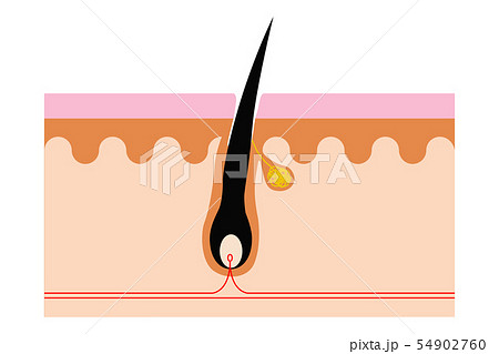 毛根の断面図 Hair scalp growth and removal 54902760