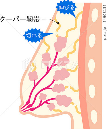 垂れたバスト クーパー靭帯のイラスト素材