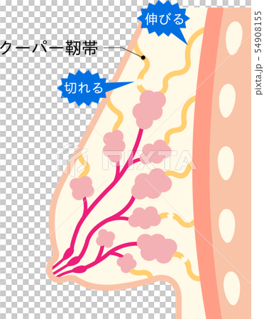 垂れたバスト　クーパー靭帯 54908155