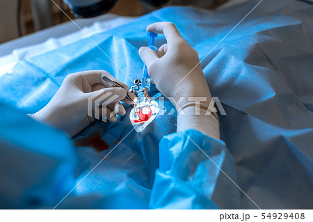 A professional ophthalmologist performs eye 54929408