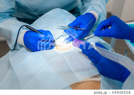 The surgeon does surgery to remove the mole on the The surgeon does surgery to remove the mole on the 54930358