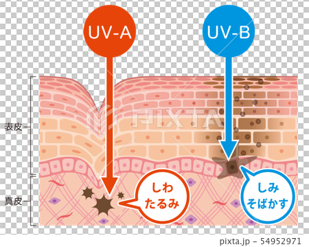 肌図　紫外線ダメージ 54952971