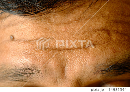 Men's skin with large pores and wrinkles. 54985544