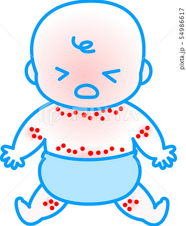 あせも 赤ちゃんのイラスト素材