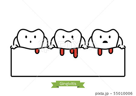 unhealthy teeth because gingivitis and bleeding unhealthy teeth because gingivitis and bleeding 55010006