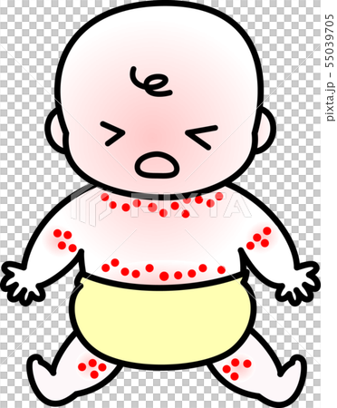 あせも　赤ちゃん 55039705