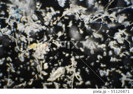 顕微鏡で拡大したハウスダストとダニの死骸 55120871