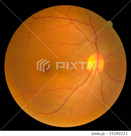 retinal 55260721