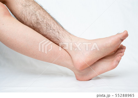 メンズ 脚脱毛 before & afterイメージ 片脚のみ メンズ 脚脱毛 before & afterイメージ 片脚のみ 55288965