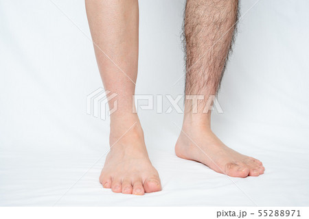 メンズ　脚脱毛　before & afterイメージ　片脚のみ 55288971