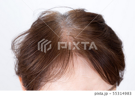 シニア　頭髪 55314983