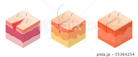 Surgical suture icons set, isometric style Surgical suture icons set, isometric style 55364254