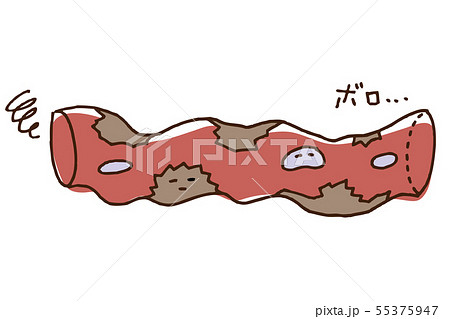 ボロボロな血管　血液 55375947