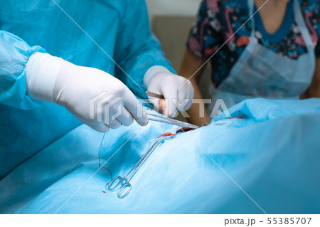 the surgeon applies a surgical clamp to stop the 55385707